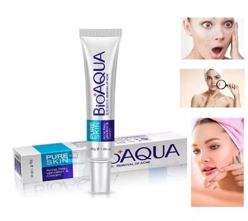 BioAqua PureSkin - Creme para tratamento de acne,cicatrizes e anti oliosidade